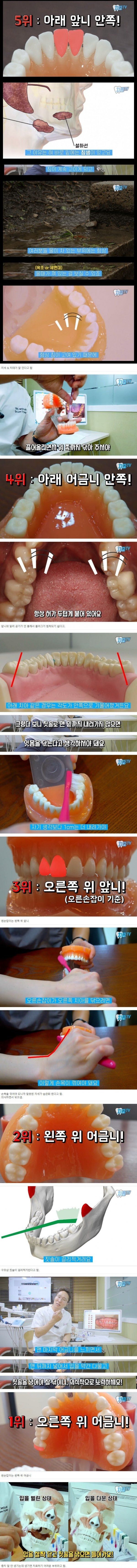 양치질할 때 특히 신경 써야 하는 부위