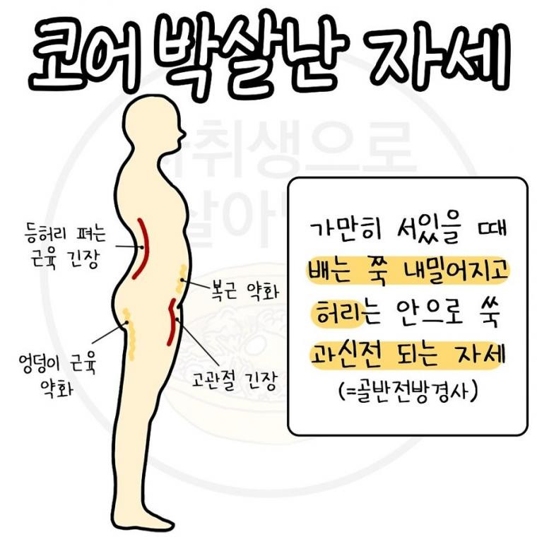 코어 박살난 자세