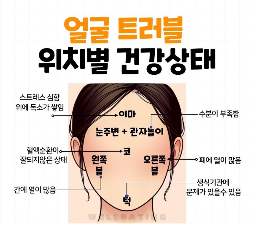 얼굴 트러블 났을때 위치별 건강상태