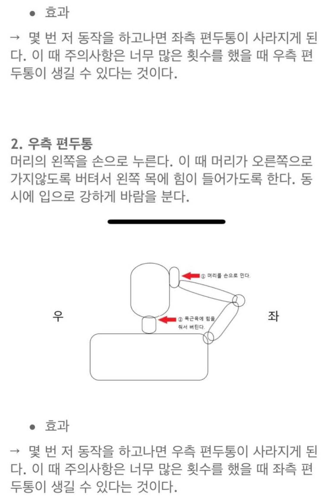 편두통 심한 사람들은 이렇게