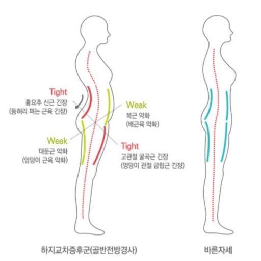 코어 박살난 자세