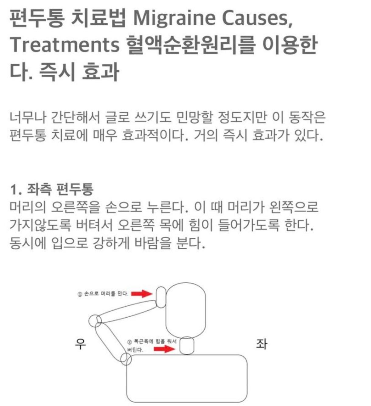 편두통 심한 사람들은 이렇게