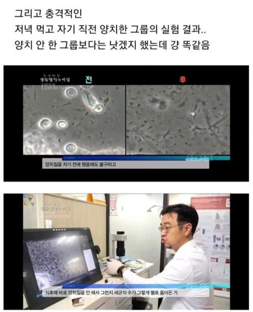 자기전 양치하는 사람들의 충격적인 결과