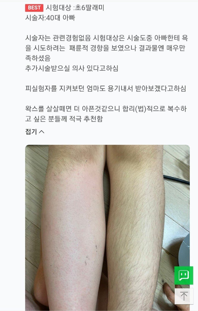 초6 딸내미 왁싱해준 40대 아빠