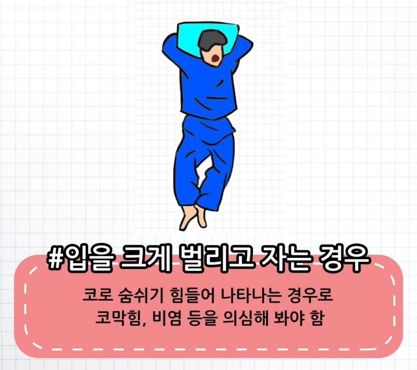 수면자세별 의심 질환