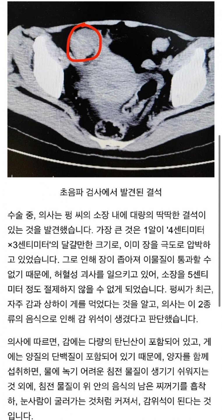 300년 만에 실제로 검증된 음모론 ㄷㄷ.jpg