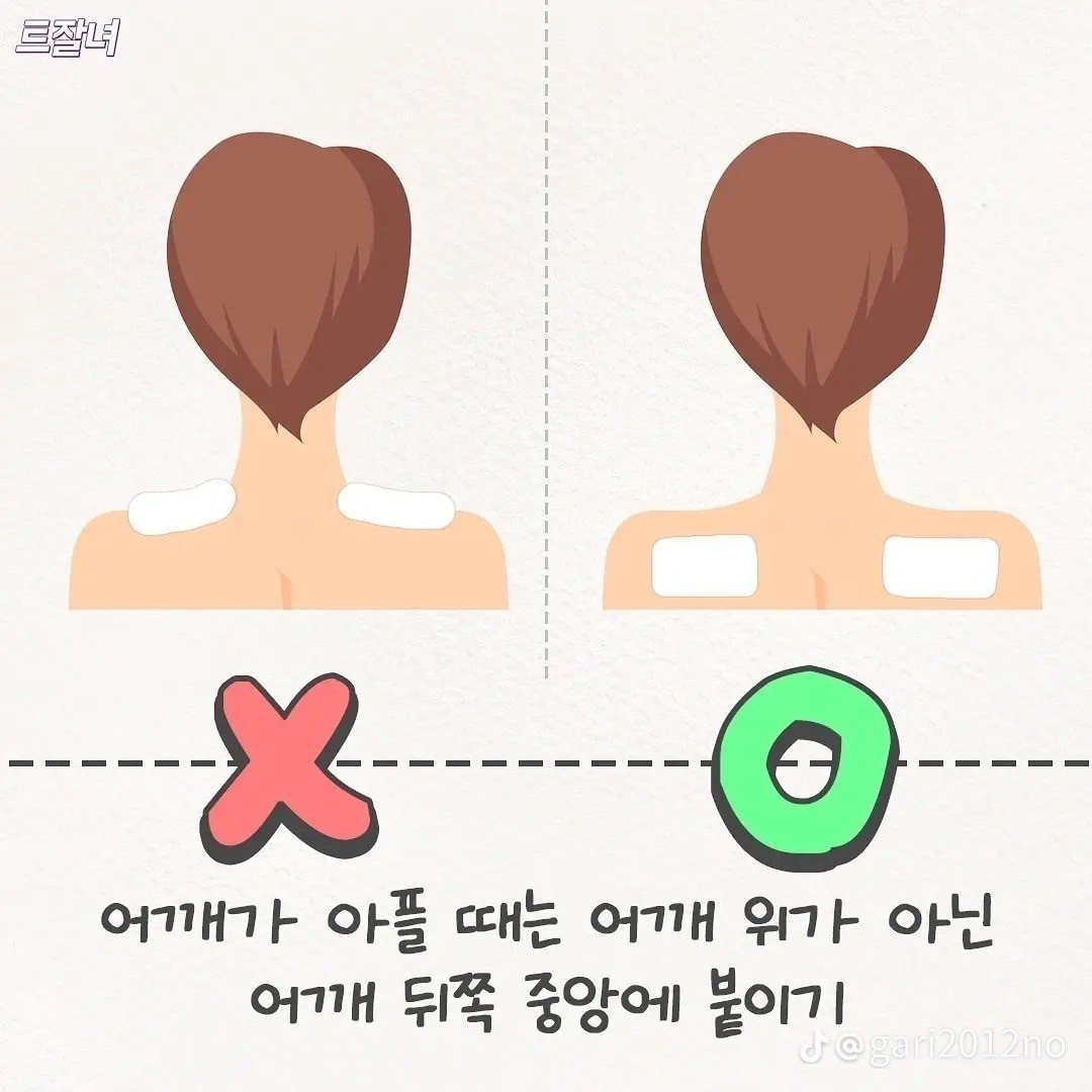 의외로 잘 모르는 파스 붙이는 꿀팁