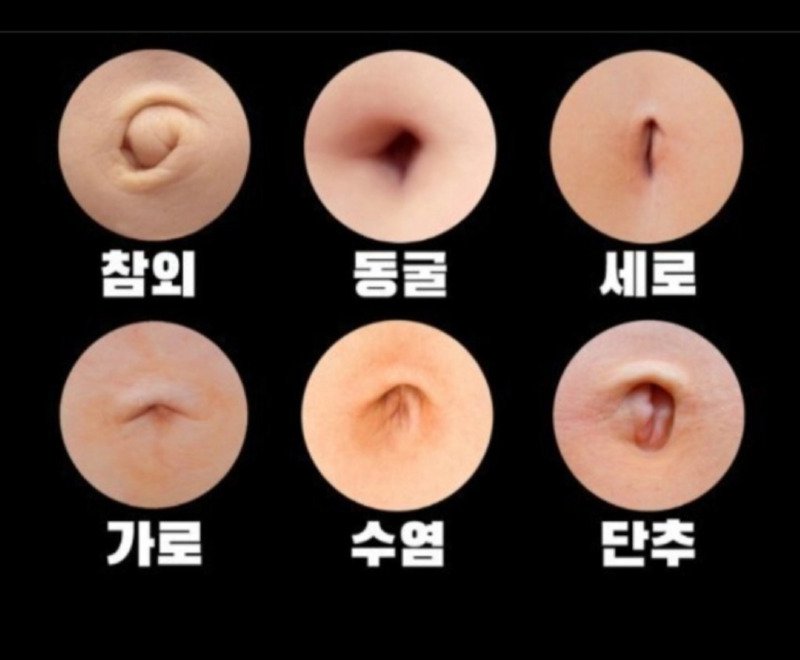 다들 배꼽 모양 뭐임?