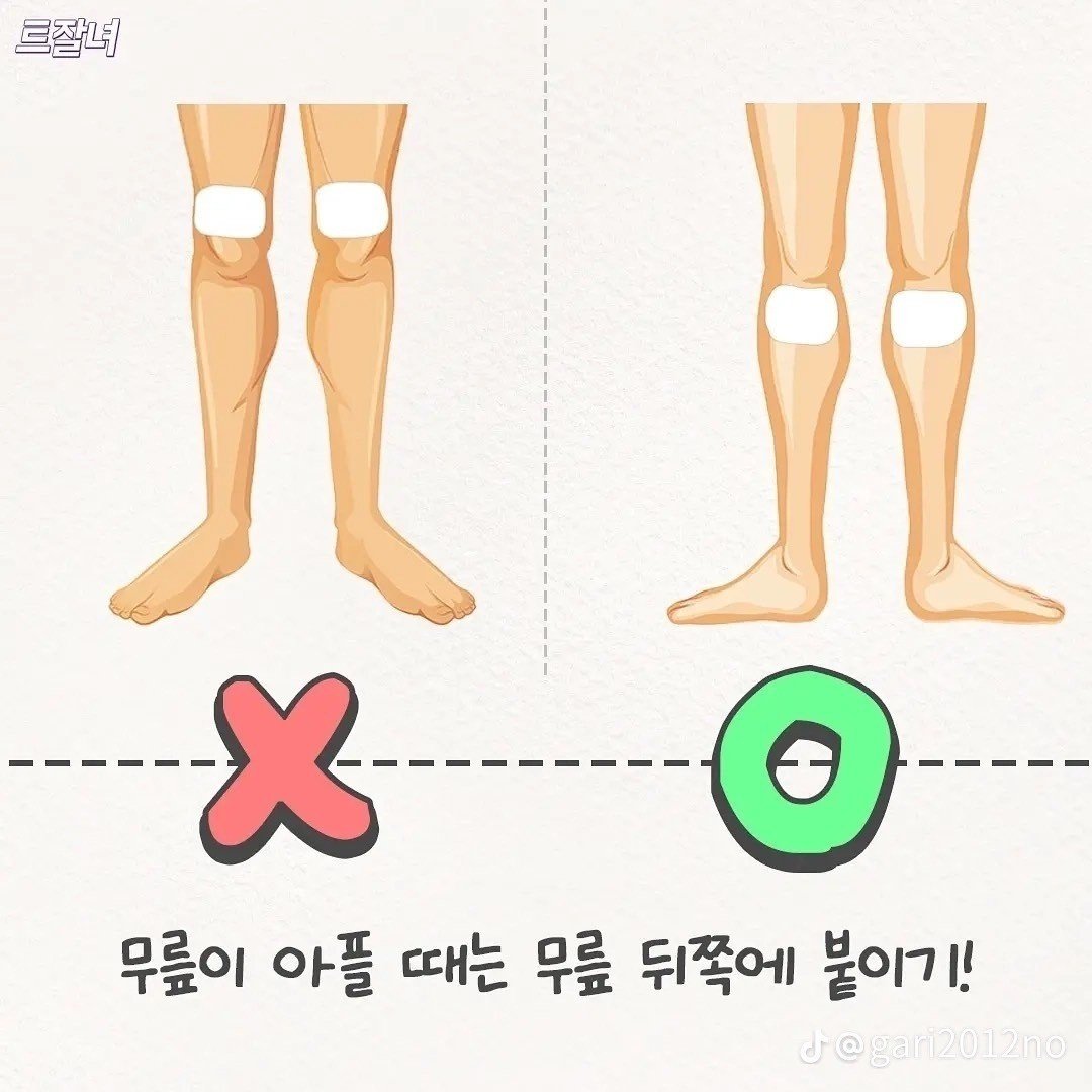 의외로 잘 모르는 파스 붙이는 꿀팁