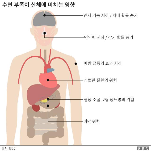 수면 부족이 신체에 미치는 영향