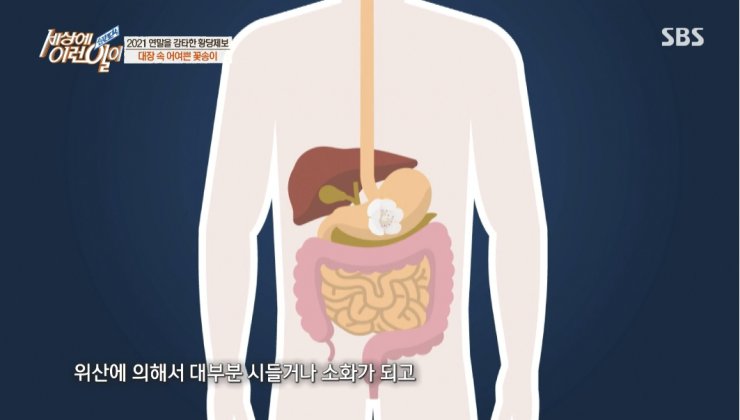 대장내시경하다 발견된거