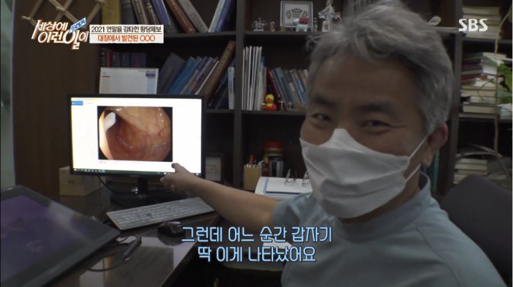 대장내시경하다 발견된거