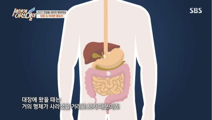 대장내시경하다 발견된거