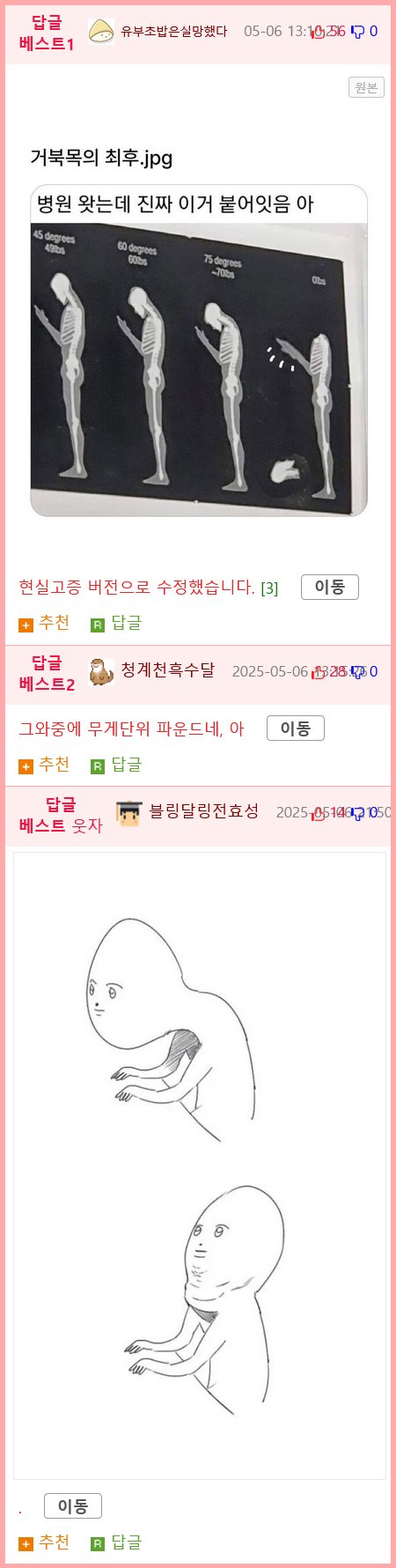 거북목의 최후.JPG