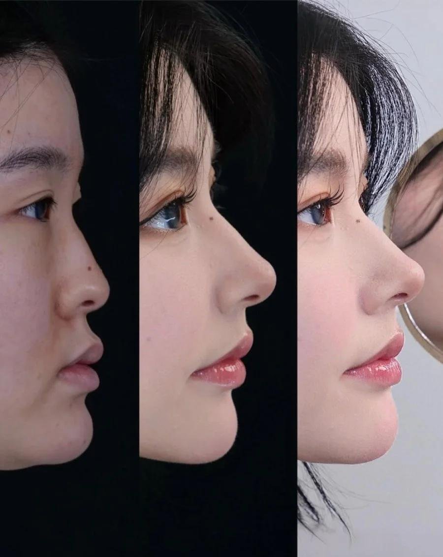 전혀 다른 사람을 만들어주는 요즘 성형