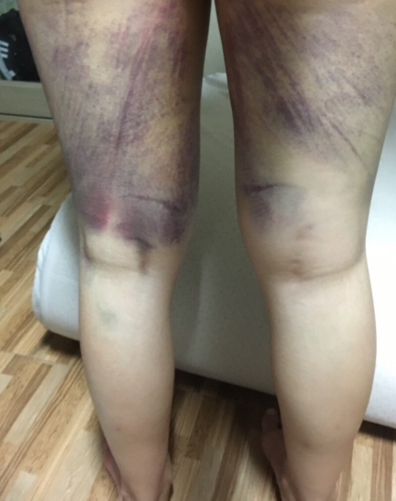 승마운동의 효과