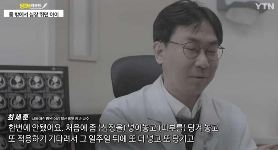혐) 심장이 밖에서 뛰는 심장이소증, 국내 최초 수술 성공