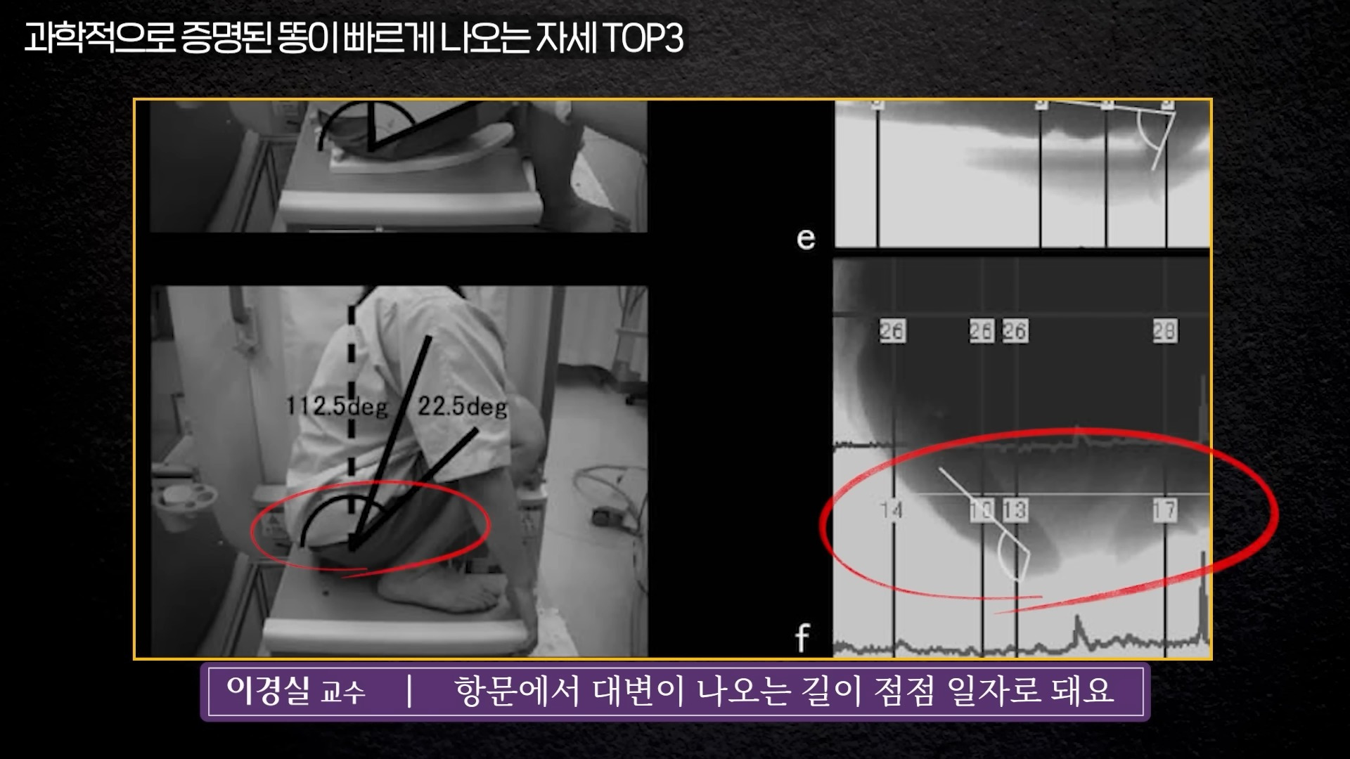 응가 닦는 방향과 응가 잘 나오는 자세 알려드림