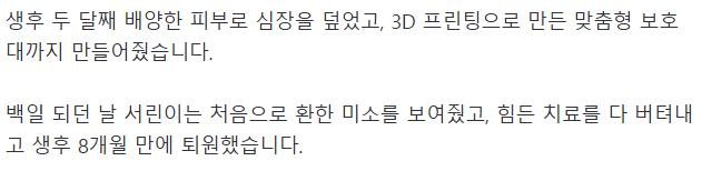 혐) 심장이 밖에서 뛰는 심장이소증, 국내 최초 수술 성공