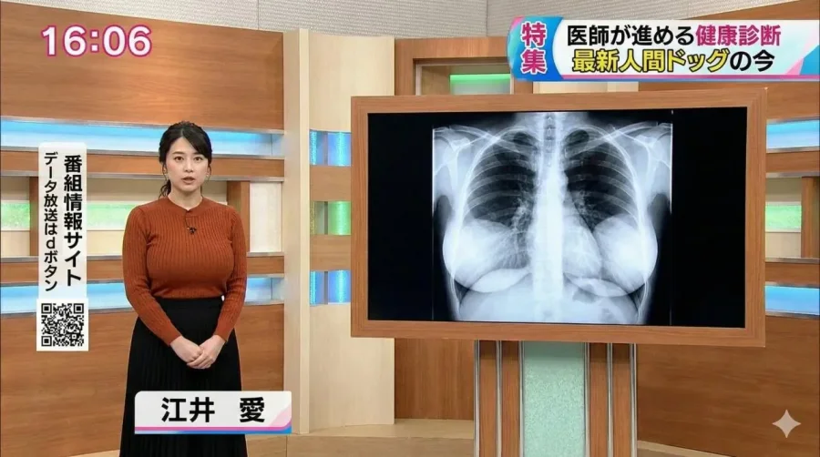 ㅇㅎ)일본 여자 아나운서 흉부 엑스레이
