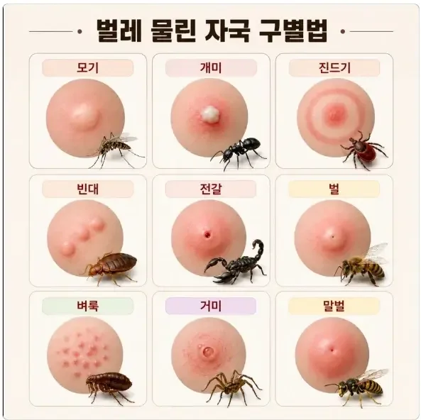 약후) 벌레 물린자국 구별법.jpg