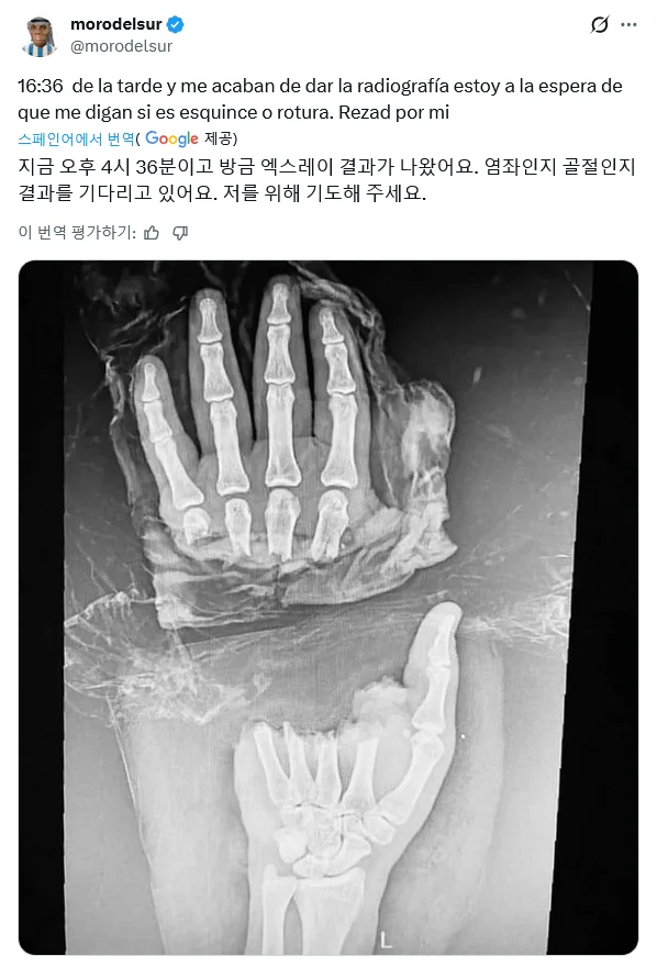 이정도면 많이 다친거임??