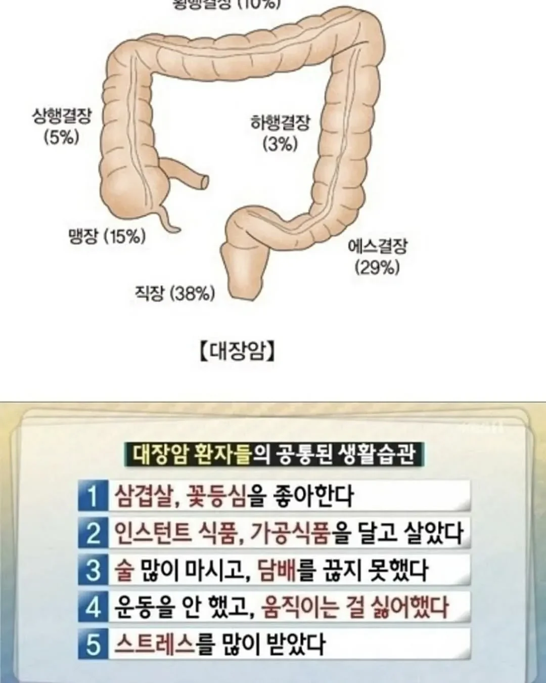 대장암 환자들의 공통된 습관